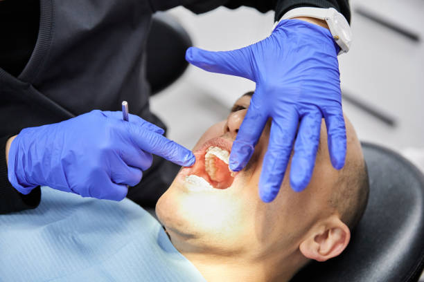 Best Emergency Treatment for Dental Infections or Abscesses in Marshallton, PA